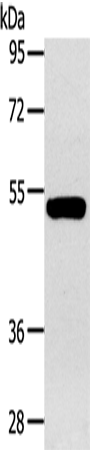 Western Blot analysis of Human fetal muscle tissue using GJA9 Polyclonal Antibody at dilution of 1:400