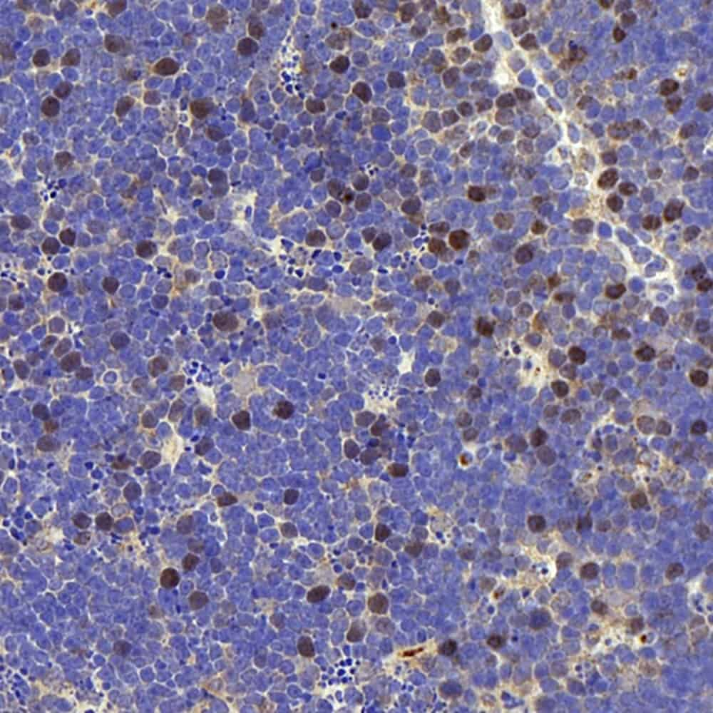 Immunohistochemistry analysis of paraffin-embedded mouse thymus  using RACGAP1 Polyclonal Antibody at dilution of 1:400.