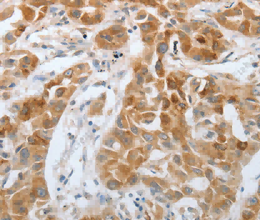 RTN4 Polyclonal Antibody - 2