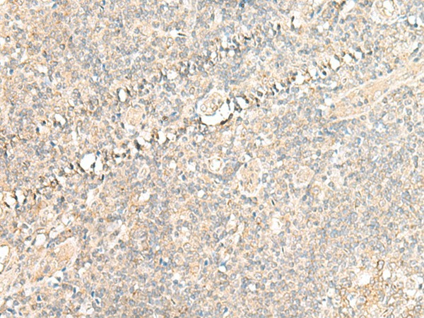 Immunohistochemistry of paraffin-embedded Human tonsil tissue  using CALCOCO1 Polyclonal Antibody at dilution of 1:50(?200)