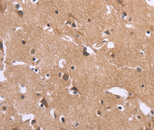 Immunohistochemistry of paraffin-embedded Human brain tissue using GPR172B Polyclonal Antibody at dilution 1:40