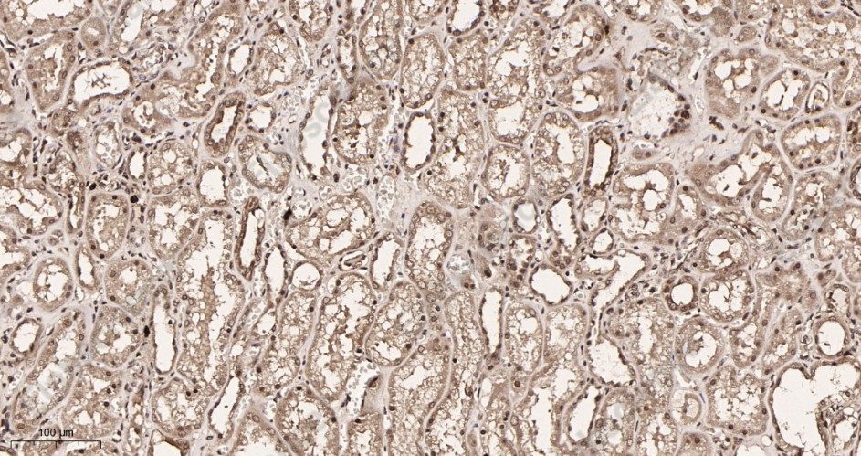 Recombinant Polycomb Protein SUZ12 Monoclonal Antibody - 2