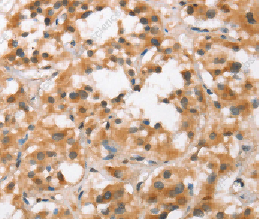 BCAS4 Polyclonal Antibody - 3