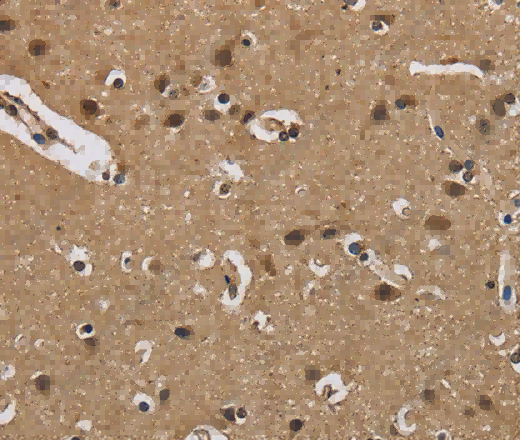 FABP2 Polyclonal Antibody - 3