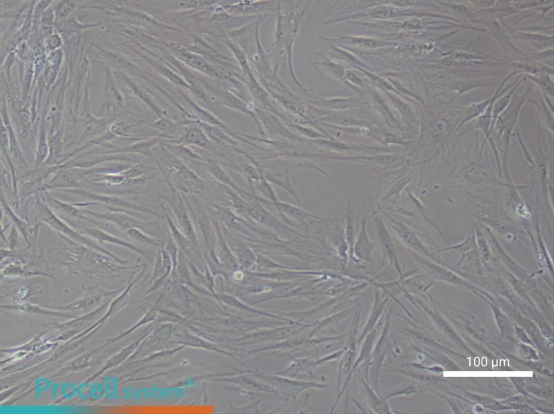 Human Synovial Fibroblast (rheumatoid arthritis) Complete Medium - 2