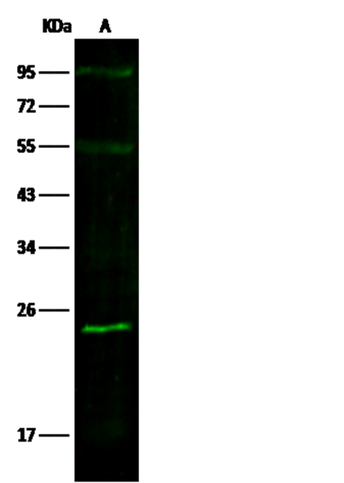 Recombinant SOD2 Monoclonal Antibody