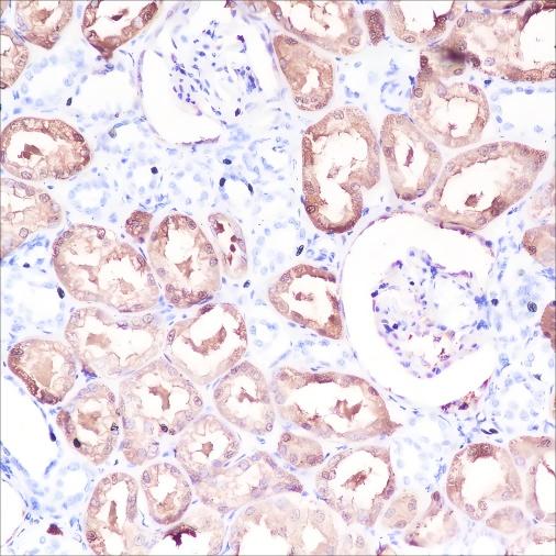 Recombinant DOPA Decarboxylase/DDC Monoclonal Antibody - small - 2