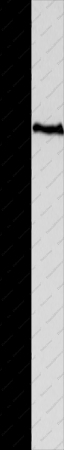 MAGED1 Polyclonal Antibody - 1