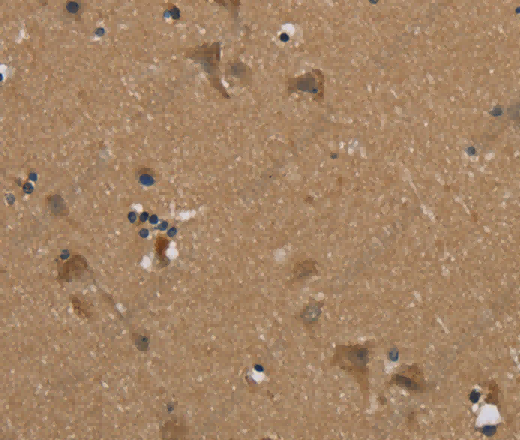 PUS10 Polyclonal Antibody - 3