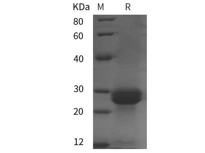 Recombinant Mouse IL-33 Protein(His Tag)-1
