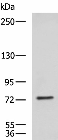 Western blot analysis of NIH/3T3 cell lysate  using KIF2A Polyclonal Antibody at dilution of 1:850