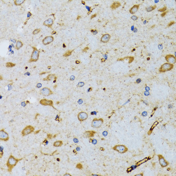 Immunohistochemistry of paraffin-embedded mouse brain using SRP19 Polyclonal antibody at dilution of 1:100 (40x lens).Perform microwave antigen retrieval with 10 mM PBS buffer pH 7.2 before commencing with IHC staining protocol.