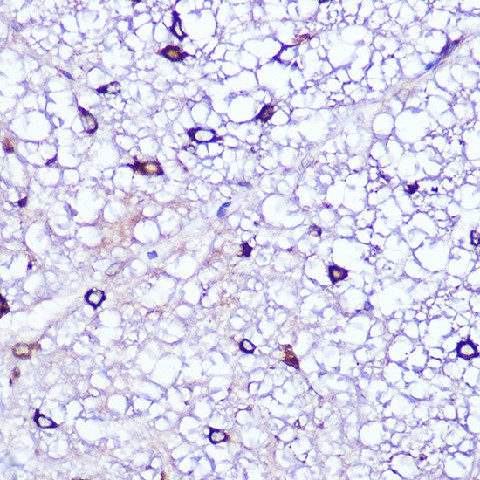 Immunohistochemistry of paraffin-embedded rat spinal cord using LATS1 Polyclonal Antibody at dilution of 1:100 (40x lens).Perform microwave antigen retrieval with 10 mM Tris/EDTA buffer pH 9.0 before commencing with IHC staining protocol.