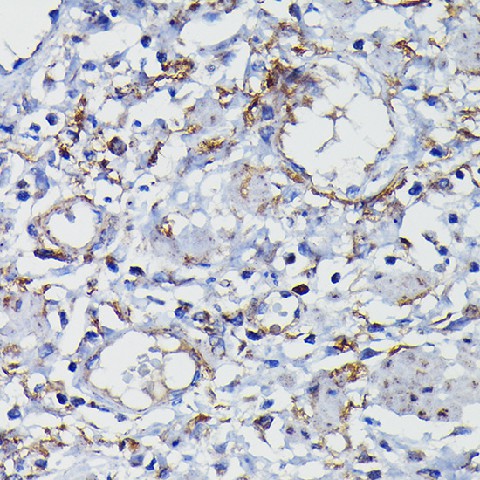 Immunohistochemistry of paraffin-embedded human esophageal using Clusterin alpha chain Polyclonal Antibody at dilution of 1:100 (40x lens).Perform high pressure antigen retrieval with 10 mM citrate buffer pH 6.0 before commencing with IHC staining protoco