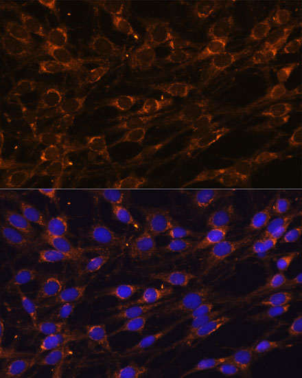 Immunofluorescence analysis of C6 cells using PREPL Polyclonal Antibody at dilution of  1:100 (40x lens). Blue: DAPI for nuclear staining.