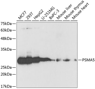 Western blot analysis of extracts of various cell lines using PSMA5 Polyclonal Antibody at 1:1000 dilution.