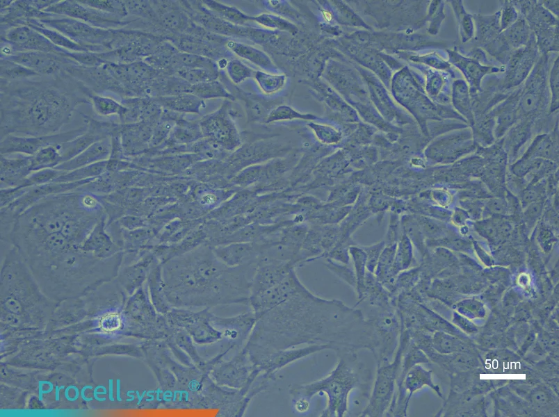 Rabbit Lung Fibroblast Complete Medium - 5