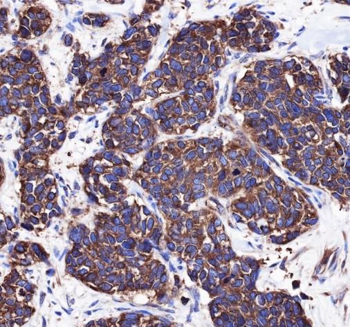 Recombinant eIF4G1 Monoclonal Antibody - small - 2