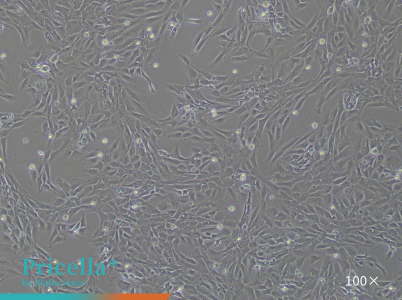 Rat Pulmonary Aorta Smooth Muscle Cells Isolation and Culture Kit - small - 2