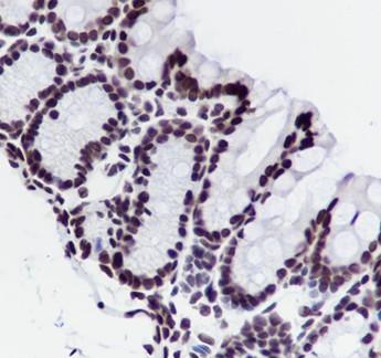 Recombinant Histone H3 (NT) Monoclonal Antibody - 3