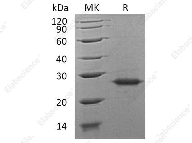 Recombinant Human Grancalcin/GCA Protein - 1