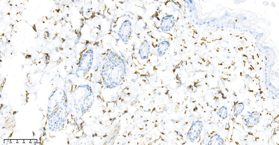Recombinant Vimentin Monoclonal Antibody - small - 2