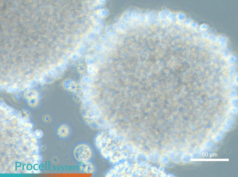 HH [Human lymphoma] - 5