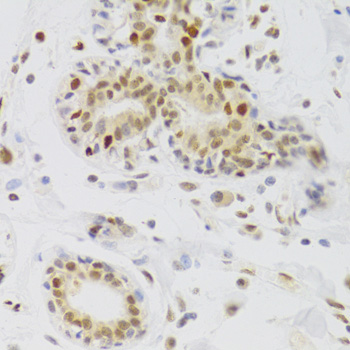 Immunohistochemistry of paraffin-embedded Human breast using NASP Polyclonal Antibody at dilution of 1:100 (40x lens).