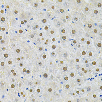 Immunohistochemistry of paraffin-embedded Rat liver using SQSTM1 / p62 Polyclonal Antibody at dilution of 1:200 (40x lens).