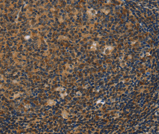 Immunohistochemistry of paraffin-embedded Human tonsil using IRF9 Polyclonal Antibody at dilution of 1:50