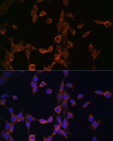 Immunofluorescence analysis of NIH/3T3 cells using PPP3R1 Polyclonal Antibody at dilution of 1:100. Blue: DAPI for nuclear staining.