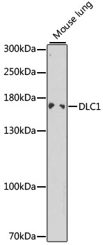 Western blot analysis of extracts of mouse lung using DLC1 Polyclonal Antibody at 1:1000 dilution.