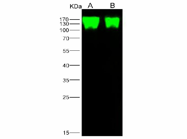 Western Blot analysis of Recombinant Epstein-Barr virus (Herpesvirus 4) EBV Glycoprotein gp350 / EBV GP350 Protein (His Tag)(PKSV030172 with 5ng and 1ng) using Anti-Epstein-Barr virus(Herpesvirus 4) EBV Glycoprotein gp350/EBV GP350 Polyclonal Antibody at dilution of 1:1000.