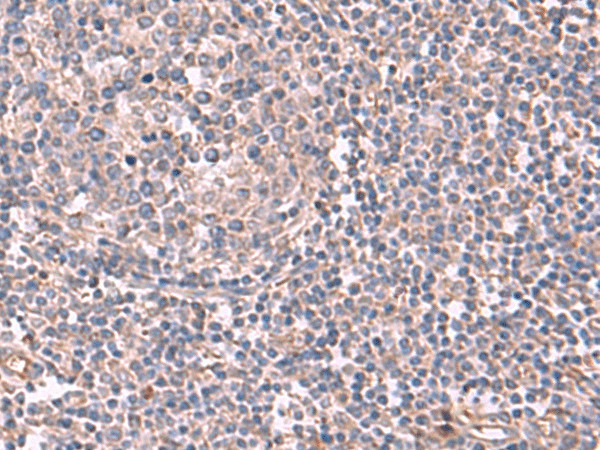 Immunohistochemistry of paraffin-embedded Human tonsil tissue  using JAZF1 Polyclonal Antibody at dilution of 1:55(?200)