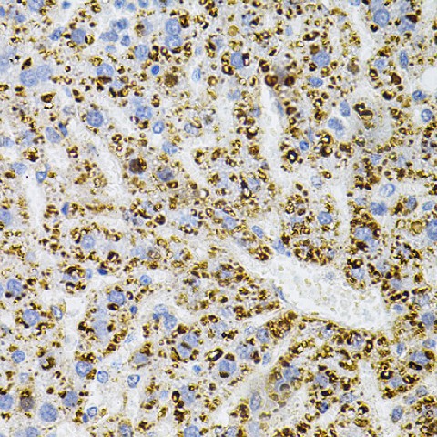 Immunohistochemistry of paraffin-embedded Rat liver using NTRK1 Polyclonal Antibody at dilution of  1:100 (40x lens).