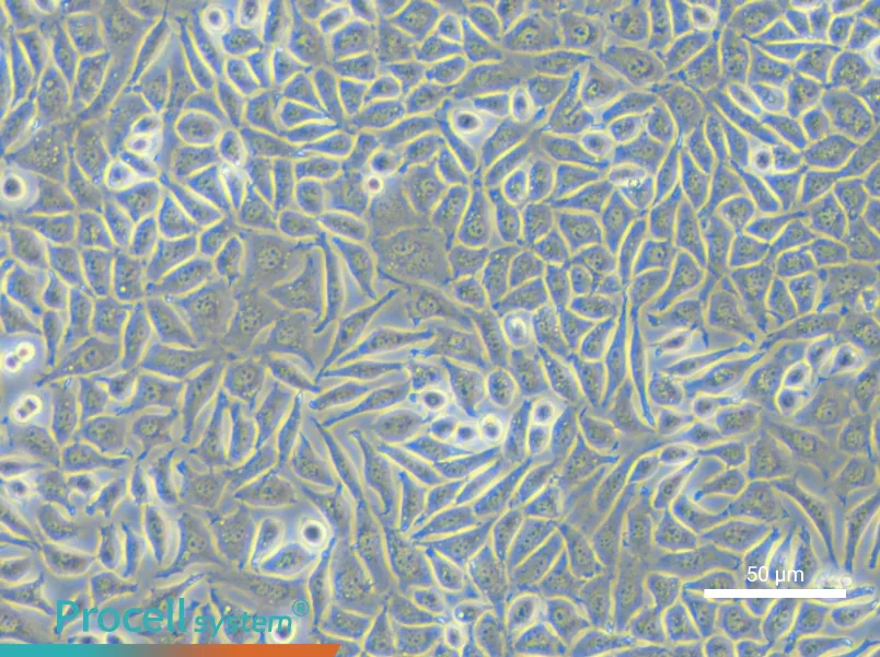 NCTC clone 929 [L cell, L-929] - 6