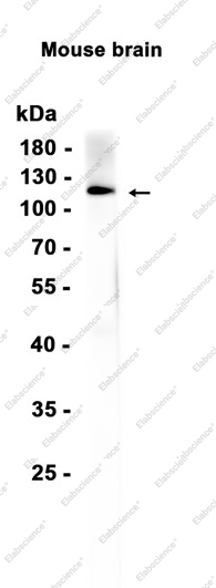 Recombinant PI3-Kinase catalytic subunit alpha Monoclonal Antibody - 1