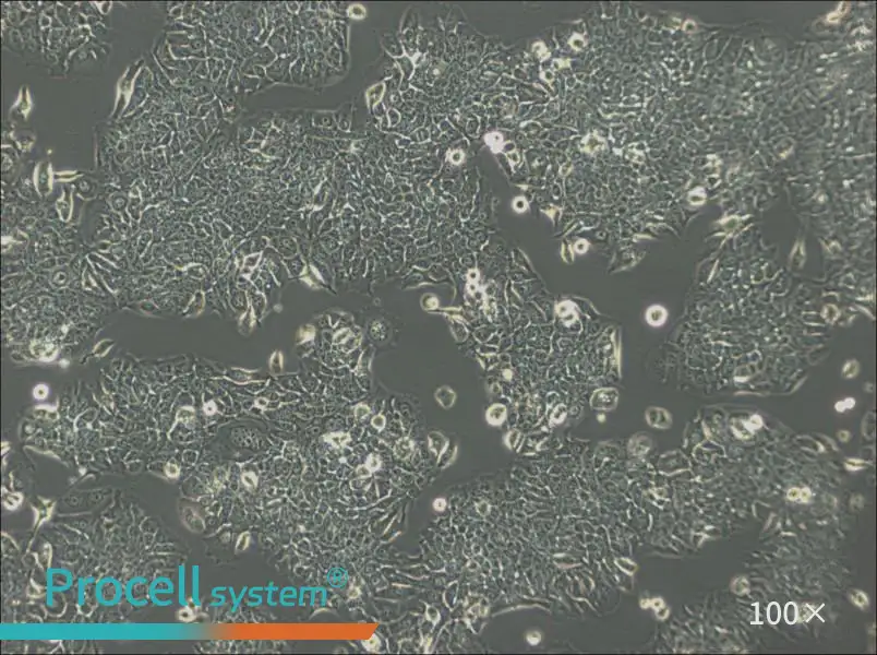JIMT-1 Cell Complete Medium - 2