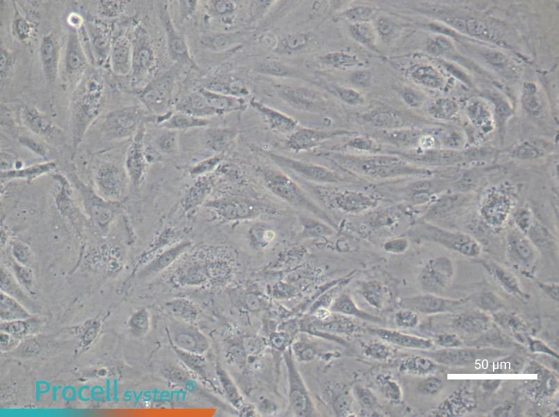 Human Aortic Endothelial (Primary cell immortalization) Cell Complete Medium - 4