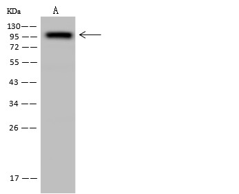 CD10 Monoclonal Antibody-searchlist-1