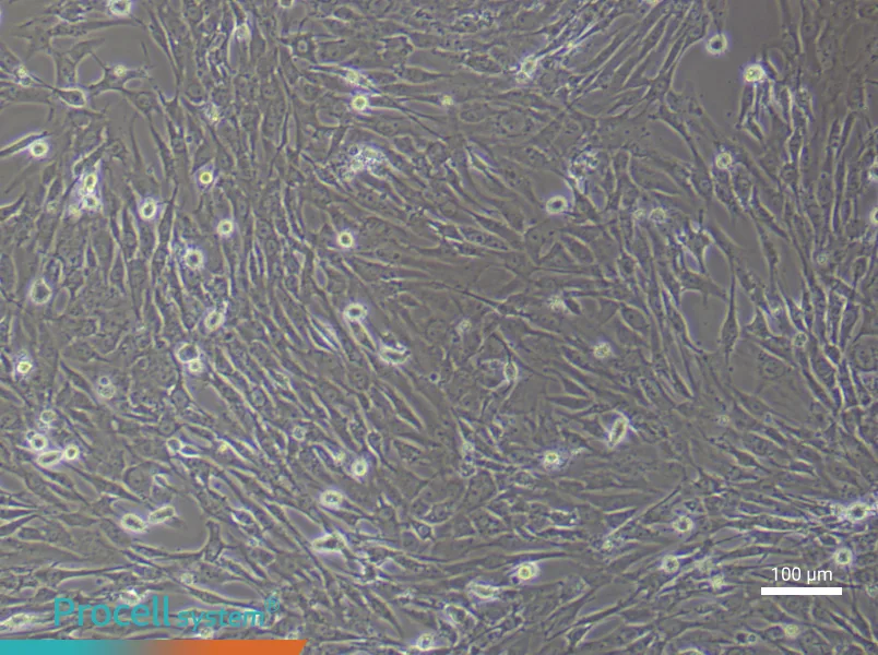 Human Lung Fibroblast (Primary cell immortalization) Complete Medium - 2