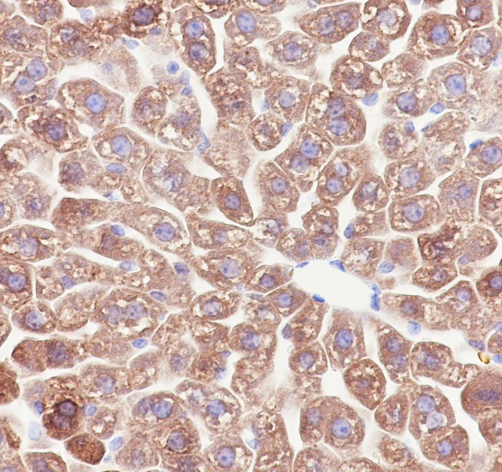 Recombinant MBL2 Monoclonal Antibody - 3