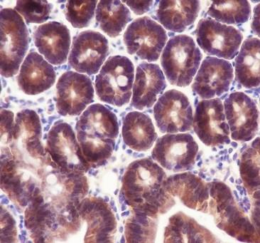 Recombinant Caspase-7 Monoclonal Antibody - 2