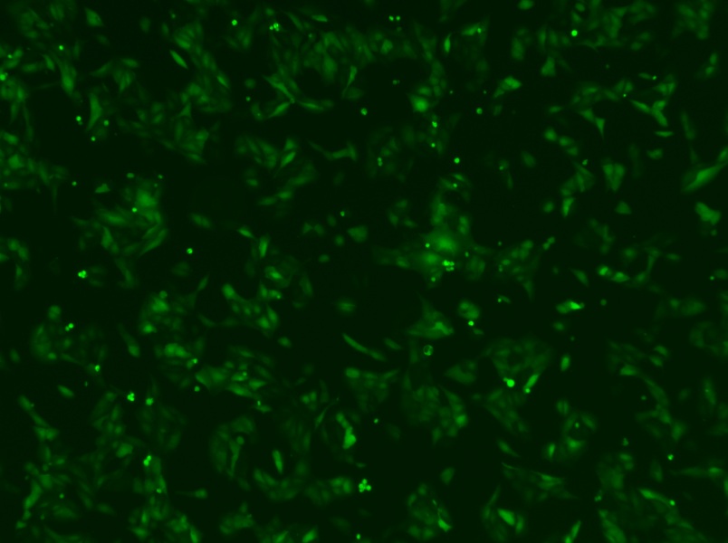 U-2 OS-LUC-EGFP Cell Complete MediumU-2 OS-LUC-EGFP Cell Complete Medium - 3
