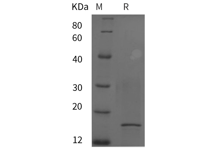 Recombinant Human IL-4 Protein-产品推荐-8