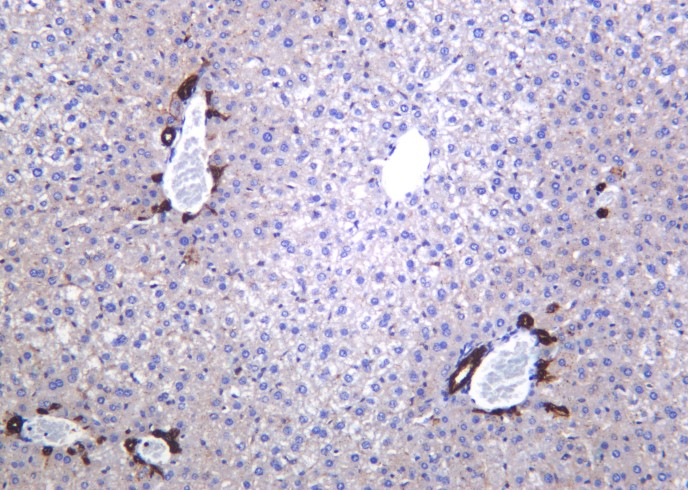 Recombinant LDLR Monoclonal Antibody-searchlist-1