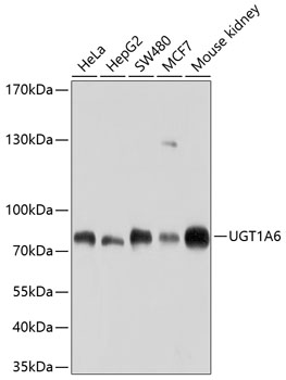 Western blot analysis of extracts of various cell lines using UGT1A6 Polyclonal Antibody at 1:1000 dilution.