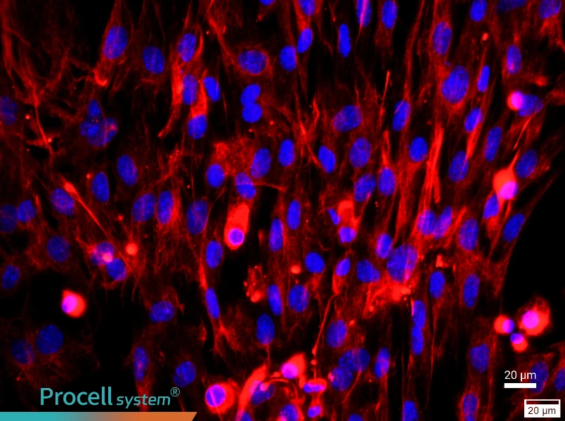 Mouse Embryonic Fibroblasts - 1