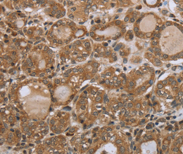 NDUFS2 Polyclonal Antibody - 2