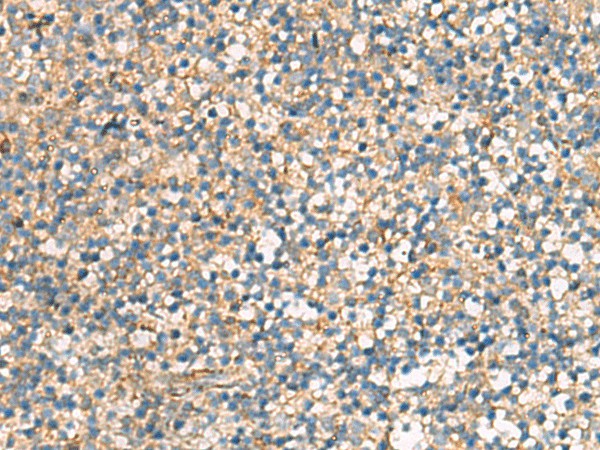 Immunohistochemistry of paraffin-embedded Human tonsil tissue  using KIF2C Polyclonal Antibody at dilution of 1:70(?200)